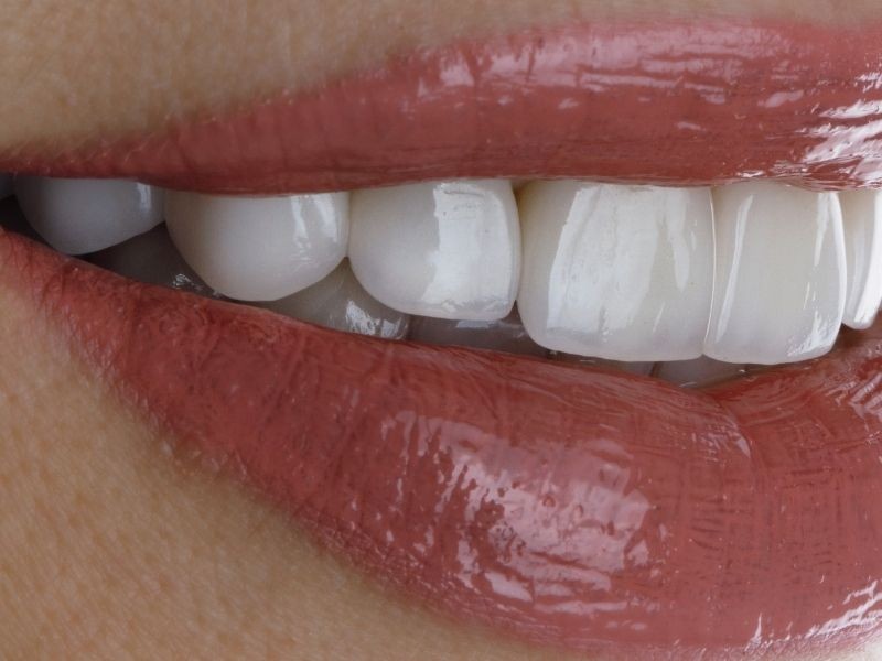 Faceta de Porcelana: O Que o Dentista Diz Sobre Mau Hálito