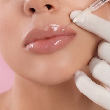 Preenchimento Labial em Moinhos de Vento