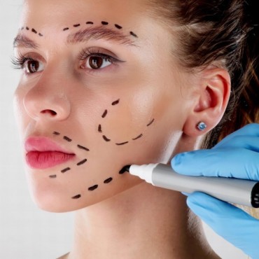 Preenchimento Facial em Moinhos de Vento