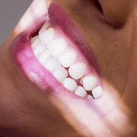 lentes-de-contato-dentais-em-porto-alegre-rs