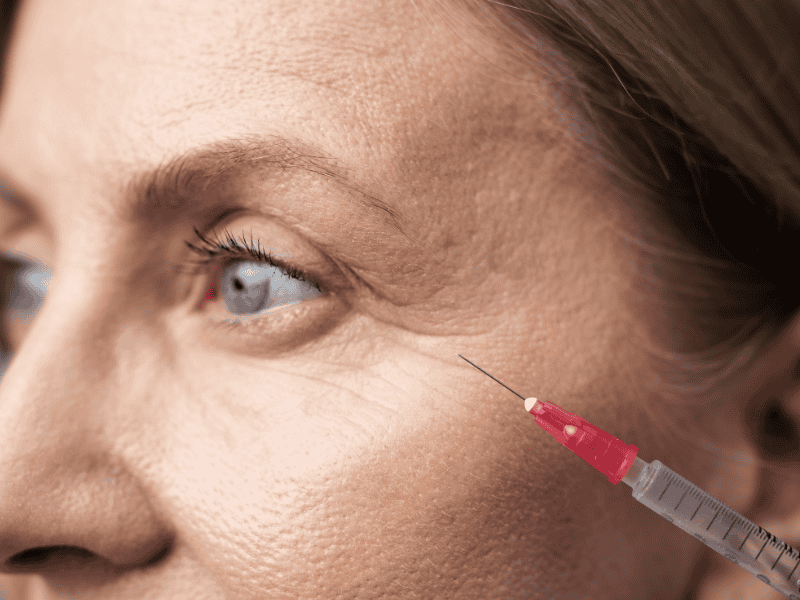 Preenchimento de Olheiras